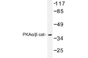 Image no. 1 for anti-Protein Kinase A, alpha (PRKACA) antibody (ABIN317665) (PRKACA anticorps)