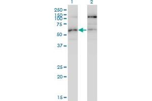 Western Blot analysis of STK38L expression in transfected 293T cell line by STK38L monoclonal antibody (M01), clone 4E5. (STK38L anticorps  (AA 1-464))