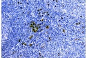 IHC analysis of Hemoglobin using anti-Hemoglobin antibody (ABIN5518839).