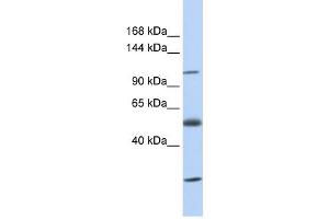 SLC39A10 antibody used at 1 ug/ml to detect target protein. (SLC39A10 anticorps)