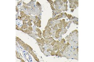 Immunohistochemistry of paraffin-embedded rat heart using HSPB8/HSP22 Rabbit pAb (ABIN3016166, ABIN3016167, ABIN3016168 and ABIN6219596) at dilution of 1:100 (40x lens).
