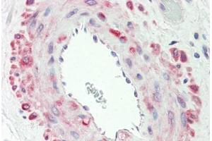 Human Vessel: Formalin-Fixed, Paraffin-Embedded (FFPE)