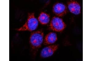 IF analysis of Presenilin 2/AD5/PSEN2 using anti-Presenilin 2/AD5/PSEN2 antibody (ABIN7602796).
