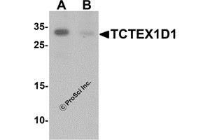 Western Blotting (WB) image for anti-Tctex1 Domain Containing 1 (TCTEX1D1) (N-Term) antibody (ABIN1587947) (TCTEX1D1 anticorps  (N-Term))