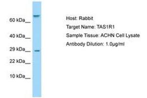 Image no. 1 for anti-Taste Receptor, Type 1, Member 1 (TAS1R1) (AA 327-376) antibody (ABIN6750003) (TAS1R1 anticorps  (AA 327-376))