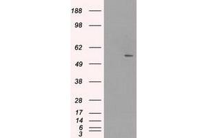Image no. 1 for anti-Solute Carrier Family 2 (Facilitated Glucose/fructose Transporter), Member 5 (SLC2A5) antibody (ABIN1498474) (SLC2A5 anticorps)