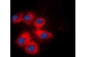 Immunofluorescent analysis of CD29 staining in NIH3T3 cells.