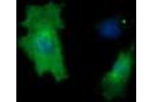 Image no. 4 for anti-Cancer/testis Antigen 1B (CTAG1B) antibody (ABIN1499892) (CTAG1B anticorps)