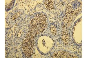 Immunohistochemistry (IHC) image for anti-Mast/stem Cell Growth Factor Receptor (KIT) (AA 957-973), (C-Term) antibody (ABIN870476)