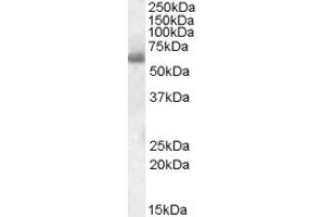 Image no. 1 for anti-SH2 Domain Containing 3A (SH2D3A) (Internal Region) antibody (ABIN375130) (SH2D3A anticorps  (Internal Region))