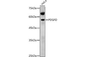 Western blot analysis of extracts of various cell lines, using PDGFD antibody (ABIN7269393) at 1:1000 dilution. (PDGFD anticorps  (AA 185-364))
