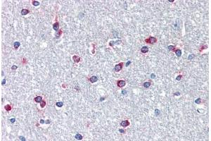 Image no. 1 for anti-Pituitary Homeobox 3 (PITX3) (N-Term) antibody (ABIN1495362) (PITX3 anticorps  (N-Term))