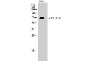 Western Blotting (WB) image for anti-V-Akt Murine Thymoma Viral Oncogene Homolog 1 (AKT1) (pSer124) antibody (ABIN3182507) (AKT1 anticorps  (pSer124))