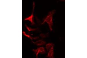 ABIN6275023 staining Hela cells by IF/ICC. (COPZ1 anticorps  (N-Term))