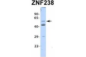 Host:  Rabbit  Target Name:  ZNF238  Sample Type:  Human Fetal Pancreas  Antibody Dilution:  1. (ZNF238 anticorps  (N-Term))