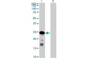 Western Blot analysis of CDKN1B expression in transfected 293T cell line by CDKN1B MaxPab polyclonal antibody. (CDKN1B anticorps  (AA 1-198))