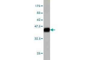 Western Blot detection against Immunogen (41. (MED21 anticorps  (AA 1-144))