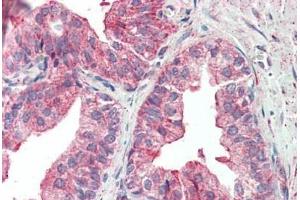 Human Prostate: Formalin-Fixed, Paraffin-Embedded (FFPE) (KIF6 anticorps  (AA 177-190))