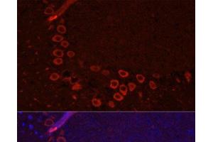Immunofluorescence analysis of Mouse brain using SLC1A1 Polyclonal Antibody at dilution of 1:100. (SLC1A1 anticorps)