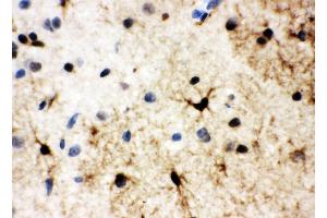 Anti-HSF2 antibody, IHC(P) IHC(P): Rat Brain Tissue (HSF2 anticorps  (Middle Region))