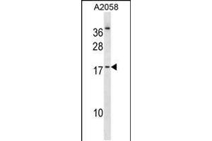 Western blot analysis in A2058 cell line lysates (35ug/lane). (NHLH2 anticorps  (AA 63-91))