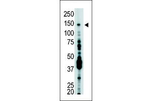 Antibody is used in Western blot to detect USP7 in T-47D cell lysate. (USP7 anticorps  (C-Term))