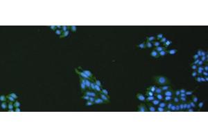 Immunofluorescence analysis of hepG2 cell using VNN1 Polyclonal Antibody at dilution of 1:100 (VNN1 anticorps)
