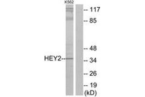Western blot analysis of extracts from K562 cells, using HEY2 Antibody.