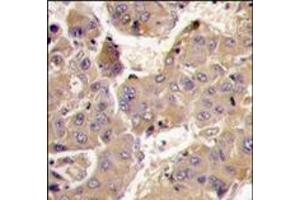 Image no. 2 for anti-Phosphatidylinositol 3-kinase regulatory subunit gamma (PIK3R3) (AA 324-353), (C-Term) antibody (ABIN360461)