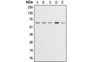 Western blot analysis of AKT (pY315) expression in HeLa (A), A549 (B), LOVO (C), HepG2 (D), NIH3T3 (E) whole cell lysates. (AKT1 anticorps  (pTyr315))