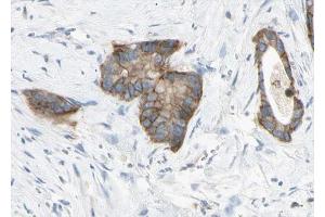 ABIN6268761 at 1/100 staining human liver tissue sections by IHC-P. (Claudin 6 anticorps  (Internal Region))
