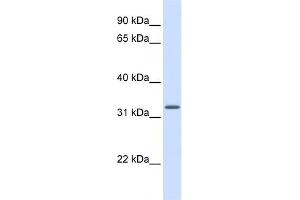 WB Suggested Anti-MRPS15 Antibody Titration: 0. (MRPS15 anticorps  (Middle Region))