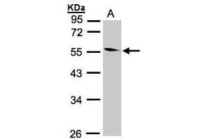 WB Image Sample(30 ug whole cell lysate) A:293T 10% SDS PAGE antibody diluted at 1:1000