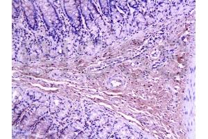 Formalin-fixed and paraffin-embedded rat colon labeled with Anti-Collagen I Polyclonal Antibody, Unconjugated (ABIN670386) 1:200 followed by conjugation to the secondary antibody and DAB staining