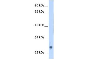 Troponin I Type 2 antibody used at 1. (TNNI2 anticorps)