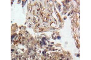 Used in DAB staining on fromalin fixed paraffin-embedded Ovary tissue