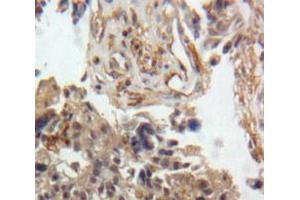 Used in DAB staining on fromalin fixed paraffin-embedded Ovary tissue (GDF9 anticorps  (AA 307-441))