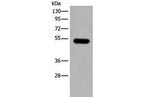 Western blot analysis of Mouse brain tissue lysate using CDKL2 Polyclonal Antibody at dilution of 1:250 (CDKL2 anticorps)