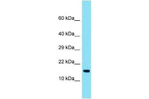 Host: Rabbit Target Name: TMEM190 Sample Type: Fetal Heart lysates Antibody Dilution: 1. (TMEM190 anticorps  (C-Term))
