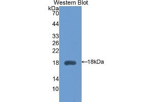 Detection of Recombinant HEXb, Mouse using Polyclonal Antibody to Hexosaminidase B Beta (HEXb) (HEXB anticorps  (AA 294-435))