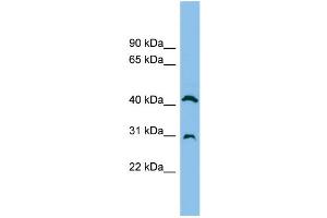 WB Suggested Anti-ADA Antibody Titration: 0. (ADA anticorps  (N-Term))