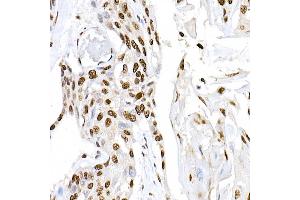 Immunohistochemistry of paraffin-embedded mouse heart using PPARγ Rabbit pAb (ABIN3020843, ABIN3020844, ABIN3020845, ABIN1513399 and ABIN6213752) at dilution of 1:200 (40x lens).