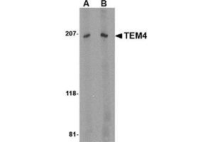 Western blot analysis of TEM4 in Jurkat Cell lysate with this product at (A) 1 and (B) 2 μg/ml.