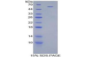 SDS-PAGE analysis of Mouse CILP Protein. (CILP Protéine)