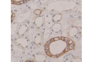 IHC-P analysis of Human Tissue, with DAB staining. (AP2M1 anticorps  (AA 170-435))