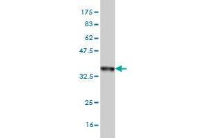 Western Blot detection against Immunogen (36. (FOXF2 anticorps  (AA 346-443))
