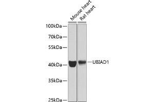 Western blot analysis of extracts of various cell lines, using UBI antibody (ABIN6134946, ABIN6149845, ABIN6149848 and ABIN6223555) at 1:1000 dilution. (UBIAD1 anticorps  (AA 1-100))