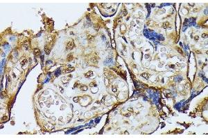 Immunohistochemistry of paraffin-embedded Human placenta using DAPK3 Polyclonal Antibody at dilution of 1:100 (40x lens). (DAPK3 anticorps)