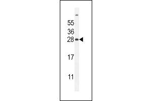 FAT10 Antibody (C-term) (ABIN655263 and ABIN2837857) western blot analysis in mouse liver tissue lysates (35 μg/lane). (UBD anticorps  (C-Term))
