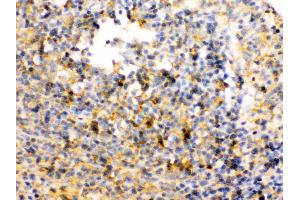 TRIB2 was detected in paraffin-embedded sections of rat spleen tissues using rabbit anti- TRIB2 Antigen Affinity purified polyclonal antibody at 1 μg/mL. (TRIB2 anticorps  (Middle Region))
